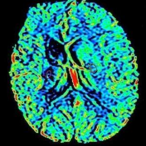 Kernspin- oder Magnetresonanztomographie (MRT)
